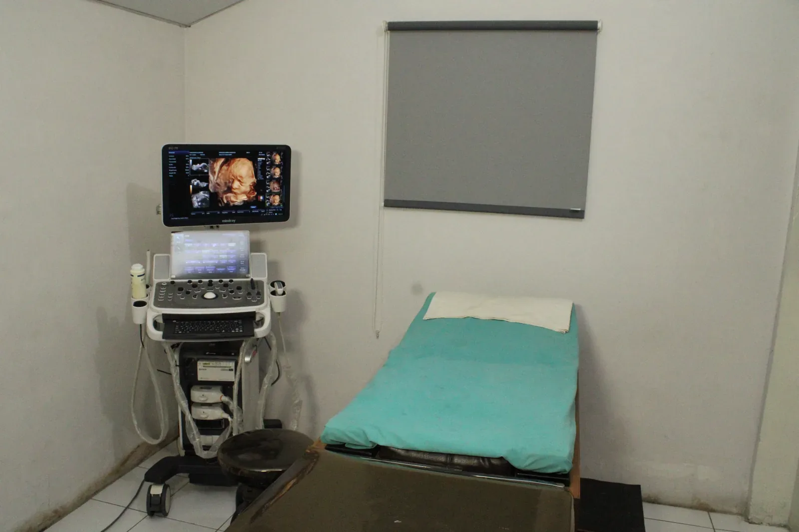 Sala y equipo de ultrasonido del Sanatorio Alvarado